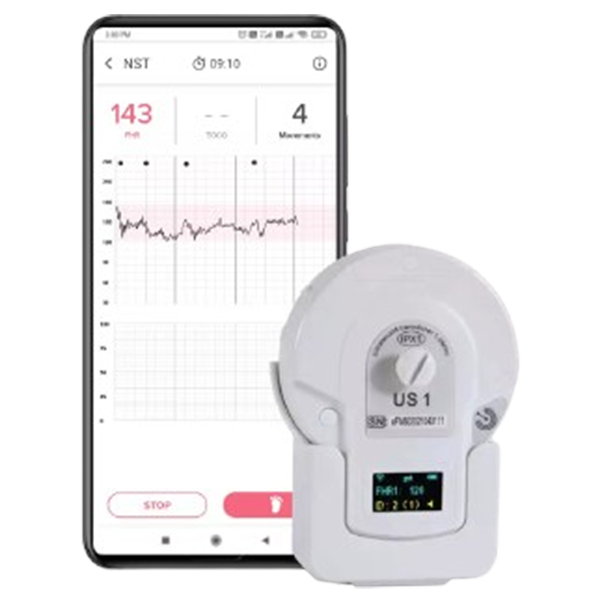 Fetal doppler Monitor on rent